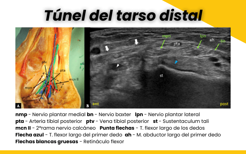 2. Tunel tarso proximal y distal ecografia tempo formacion.png